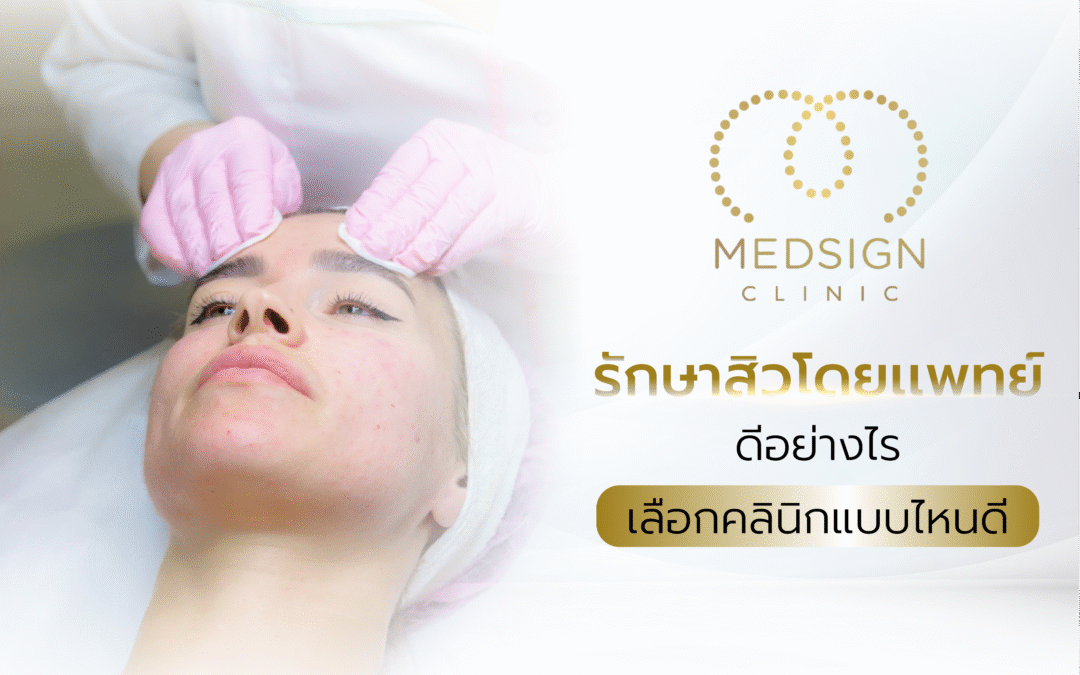 รักษาสิวโดยแพทย์