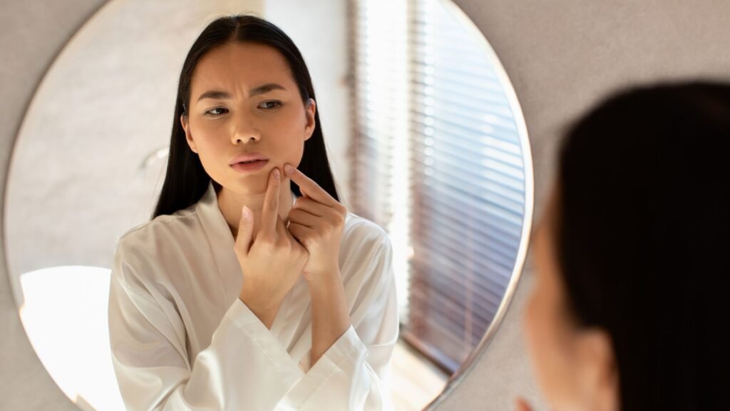 การดูแลผิวหลังการ “กดสิว” ที่ถูกวิธี