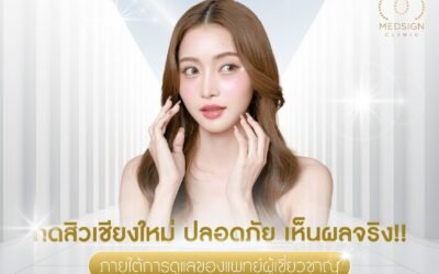 กดสิวเชียงใหม่ ปลอดภัย เห็นผลจริง ภายใต้การดูแลของแพทย์ผู้เชี่ยวชาญ