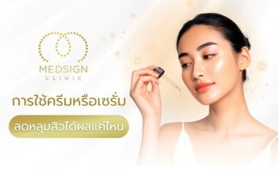 การใช้ครีมหรือเซรั่มลดหลุมสิวได้ผลแค่ไหน