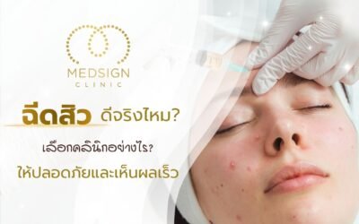 ฉีดสิวเชียงใหม่ ดีจริงไหม เลือกคลินิกอย่างไรให้ปลอดภัยและเห็นผลเร็ว