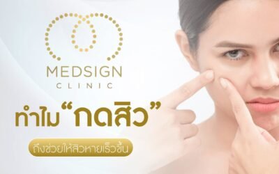 ทำไมต้อง กดสิว ถึงช่วยให้สิวหายเร็วขึ้น