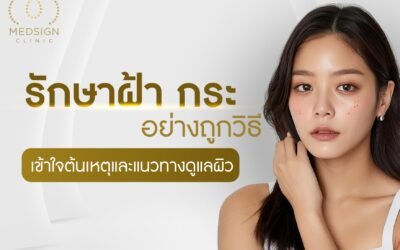 รักษาฝ้ากระ อย่างถูกวิธีเข้าใจต้นเหตุและแนวทางดูแลผิว