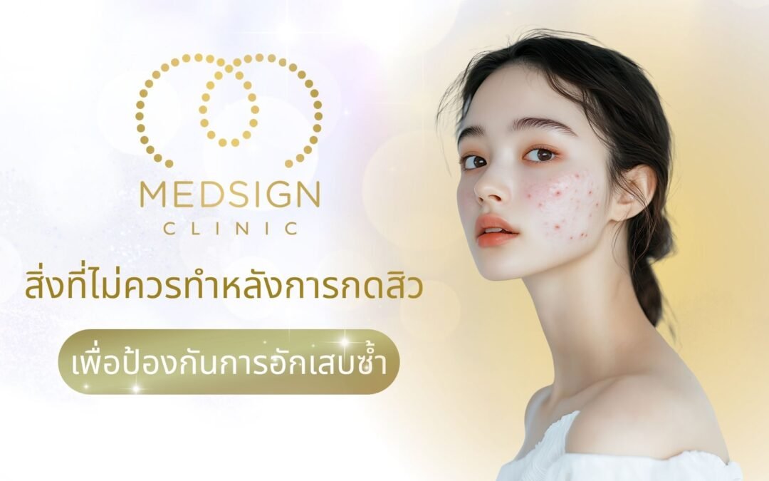 สิ่งที่ไม่ควรทำหลังการกดสิว เพื่อป้องกันการอักเสบซ้ำ ดูแลผิวให้ถูกวิธีหลังการกดสิวเชียงใหม่ ใกล้ฉัน