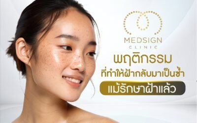 แม้ รักษาฝ้า แล้วแต่ยังทำพฤติกรรมที่ทำให้ฝ้ากลับมาเป็นซ้ำ