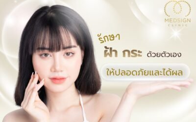 รักษาฝ้ากระด้วยตัวเอง ได้ไหมคู่มือดูแลผิวอย่างปลอดภัย