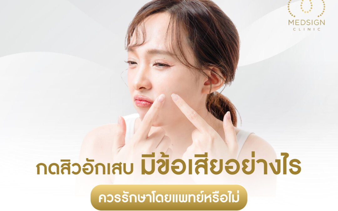 กดสิวอักเสบ มีข้อเสียอย่างไร ควรรักษาโดยแพทย์หรือไม่