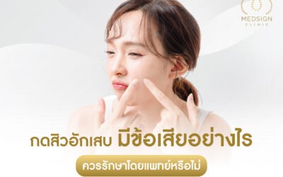 กดสิวอักเสบ มีข้อเสียอย่างไร ควรรักษาโดยแพทย์หรือไม่